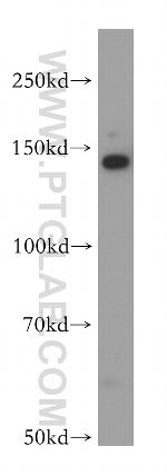 SFI1 Antibody in Western Blot (WB)