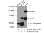 IKZF2 Antibody in Immunoprecipitation (IP)