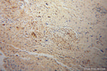 APC2 Antibody in Immunohistochemistry (Paraffin) (IHC (P))