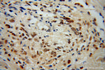 APC2 Antibody in Immunohistochemistry (Paraffin) (IHC (P))