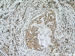 APC2 Antibody in Immunohistochemistry (Paraffin) (IHC (P))