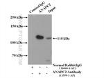 APC2 Antibody in Immunoprecipitation (IP)