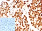 Carboxypeptidase A1/CPA1 (Pancreatic Cancer Marker) Antibody in Immunohistochemistry (Paraffin) (IHC (P))