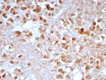 Carboxypeptidase A1/CPA1 (Pancreatic Cancer Marker) Antibody in Immunohistochemistry (Paraffin) (IHC (P))