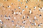 SIRT6 Antibody in Immunohistochemistry (Paraffin) (IHC (P))