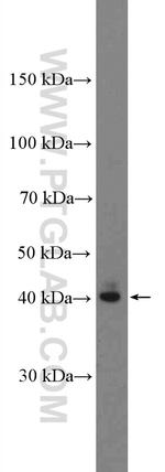 SIRT6 Antibody in Western Blot (WB)