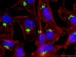 TGN46 Antibody in Immunocytochemistry (ICC/IF)