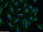 TGN46 Antibody in Immunocytochemistry (ICC/IF)