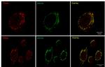 TGN46 Antibody in Immunocytochemistry (ICC/IF)