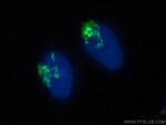 TGN46 Antibody in Immunocytochemistry (ICC/IF)