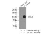 TGN46 Antibody in Immunoprecipitation (IP)