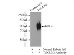 TGN46 Antibody in Immunoprecipitation (IP)