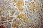 ABCG1 Antibody in Immunohistochemistry (Paraffin) (IHC (P))