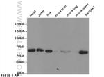 ABCG1 Antibody in Western Blot (WB)