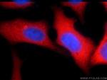 YAP1 Antibody in Immunocytochemistry (ICC/IF)