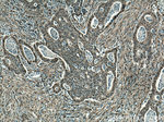 YAP1 Antibody in Immunohistochemistry (Paraffin) (IHC (P))