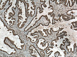 YAP1 Antibody in Immunohistochemistry (Paraffin) (IHC (P))