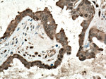 YAP1 Antibody in Immunohistochemistry (Paraffin) (IHC (P))