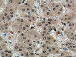 YAP1 Antibody in Immunohistochemistry (Paraffin) (IHC (P))