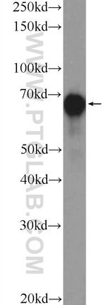 YAP1 Antibody in Western Blot (WB)