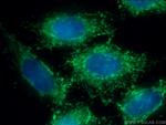 PRDX6 Antibody in Immunocytochemistry (ICC/IF)