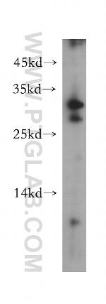 CLEC10A/CD301 Antibody in Western Blot (WB)