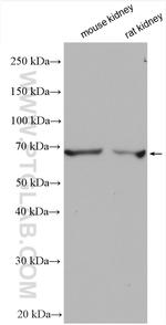 SLC22A2 Antibody in Western Blot (WB)