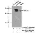 FBXO22 Antibody in Immunoprecipitation (IP)