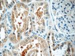 TOB2 Antibody in Immunohistochemistry (Paraffin) (IHC (P))