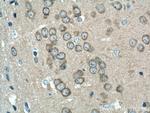 CAMK1D Antibody in Immunohistochemistry (Paraffin) (IHC (P))