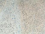 CAMK1D Antibody in Immunohistochemistry (Paraffin) (IHC (P))