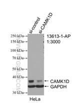 CAMK1D Antibody in Western Blot (WB)