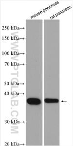 CAMK1D Antibody in Western Blot (WB)