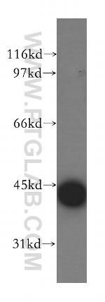 CAMK1D Antibody in Western Blot (WB)