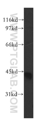 CAMK1D Antibody in Western Blot (WB)