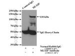MLXIP Antibody in Immunoprecipitation (IP)