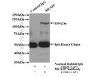 MLXIP Antibody in Immunoprecipitation (IP)