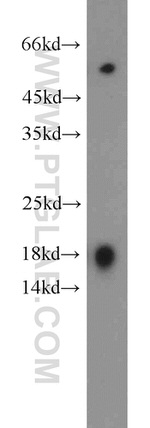 IFT20 Antibody in Western Blot (WB)