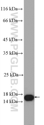 IFT20 Antibody in Western Blot (WB)