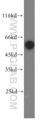 ST3GAL2 Antibody in Western Blot (WB)