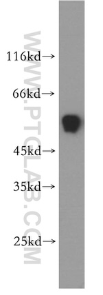 ST3GAL2 Antibody in Western Blot (WB)