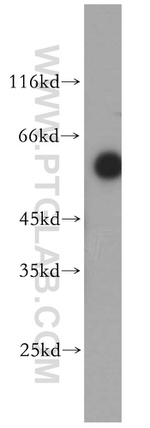 ST3GAL2 Antibody in Western Blot (WB)