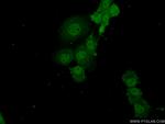 ADAT2 Antibody in Immunocytochemistry (ICC/IF)