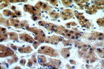 ADAT2 Antibody in Immunohistochemistry (Paraffin) (IHC (P))