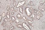 ADAT2 Antibody in Immunohistochemistry (Paraffin) (IHC (P))