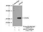 ADAT2 Antibody in Immunoprecipitation (IP)