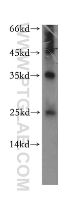 ADAT2 Antibody in Western Blot (WB)