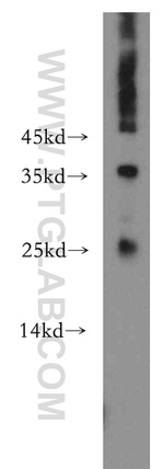 ADAT2 Antibody in Western Blot (WB)