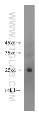 ADAT2 Antibody in Western Blot (WB)