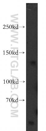 KCNH7 Antibody in Western Blot (WB)